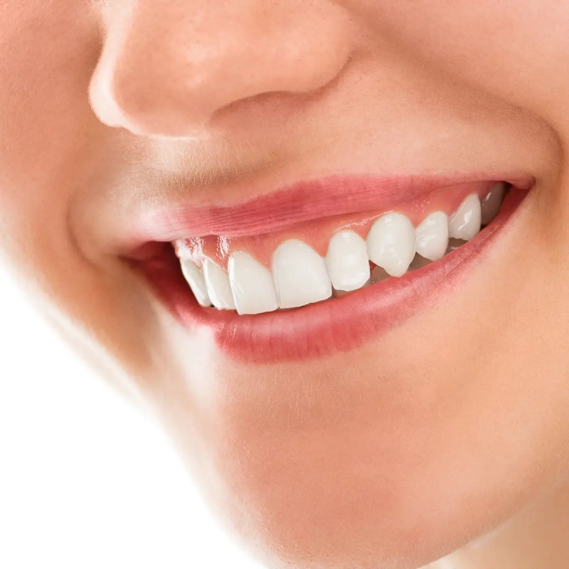 Cara Agar Gigi Lebih Putih
