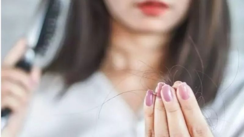 Cara Mengurangi Rambut Rontok Berlebihan