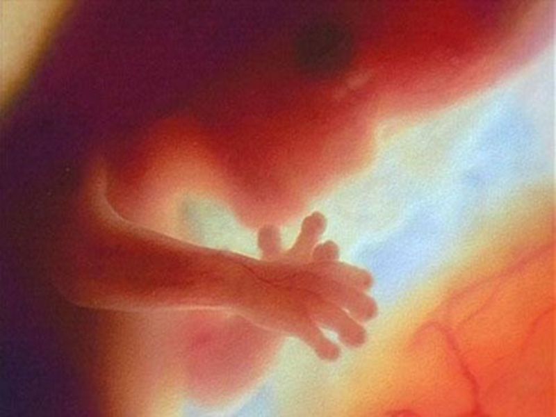Proses Kehamilan Dan Perkembangan Janin Dalam Kandungan
